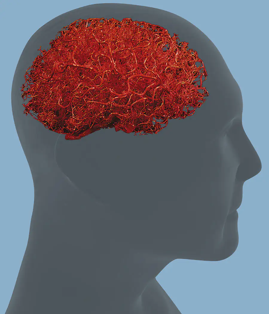 vascular - cerebral blood flow vascular - cerebral blood flow