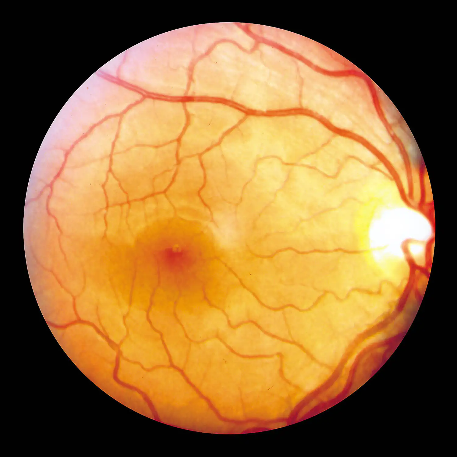 retina of the eye retina of the eye