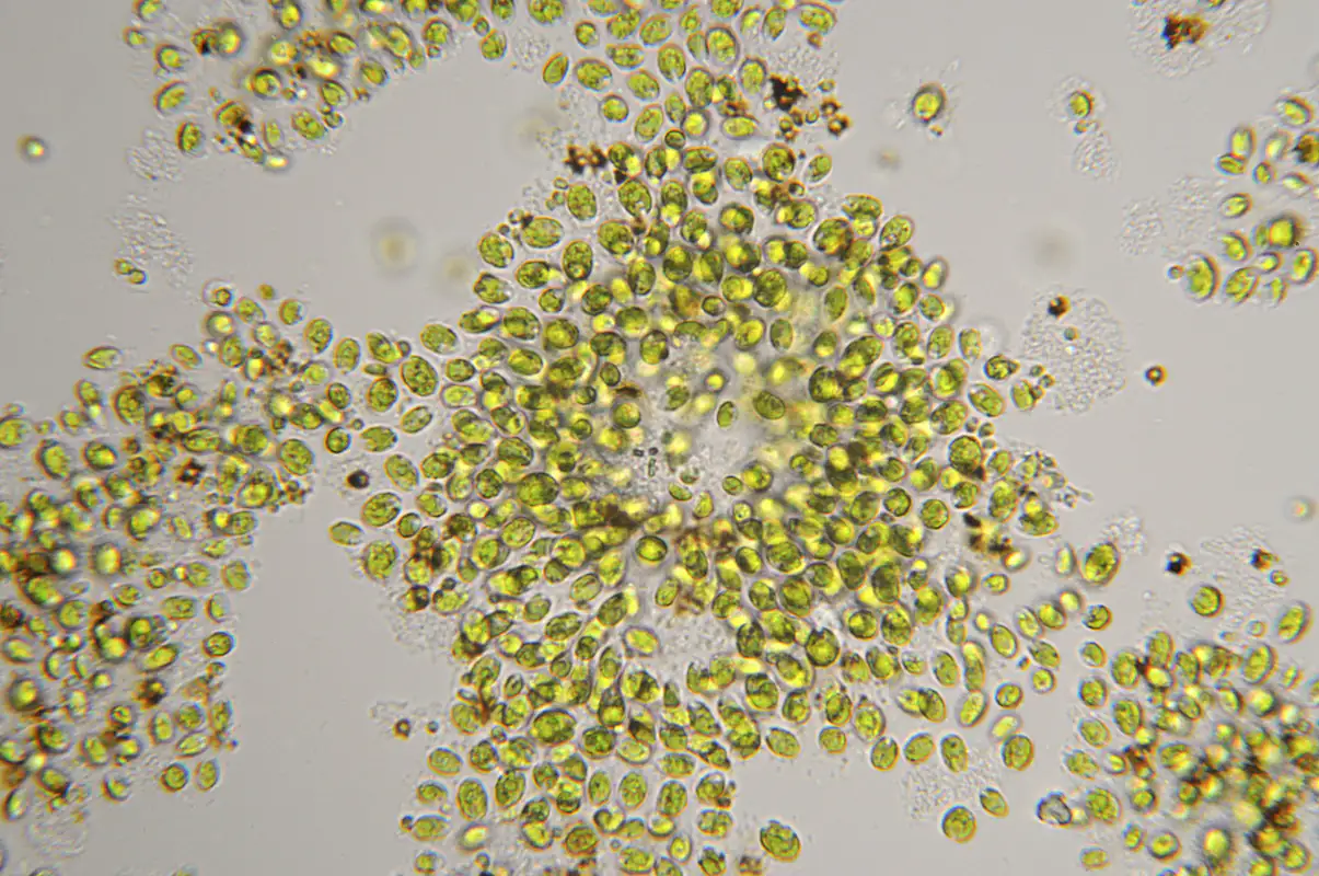 Chlorella vulgaris under the microscope Chlorella vulgaris under the microscope